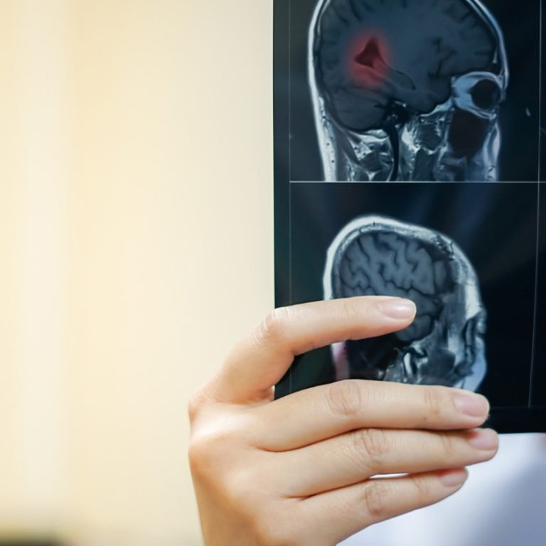 image_0001_woman-hand-radiologist-holding-mri-brain-film-see-diagnostic-report-medical-c